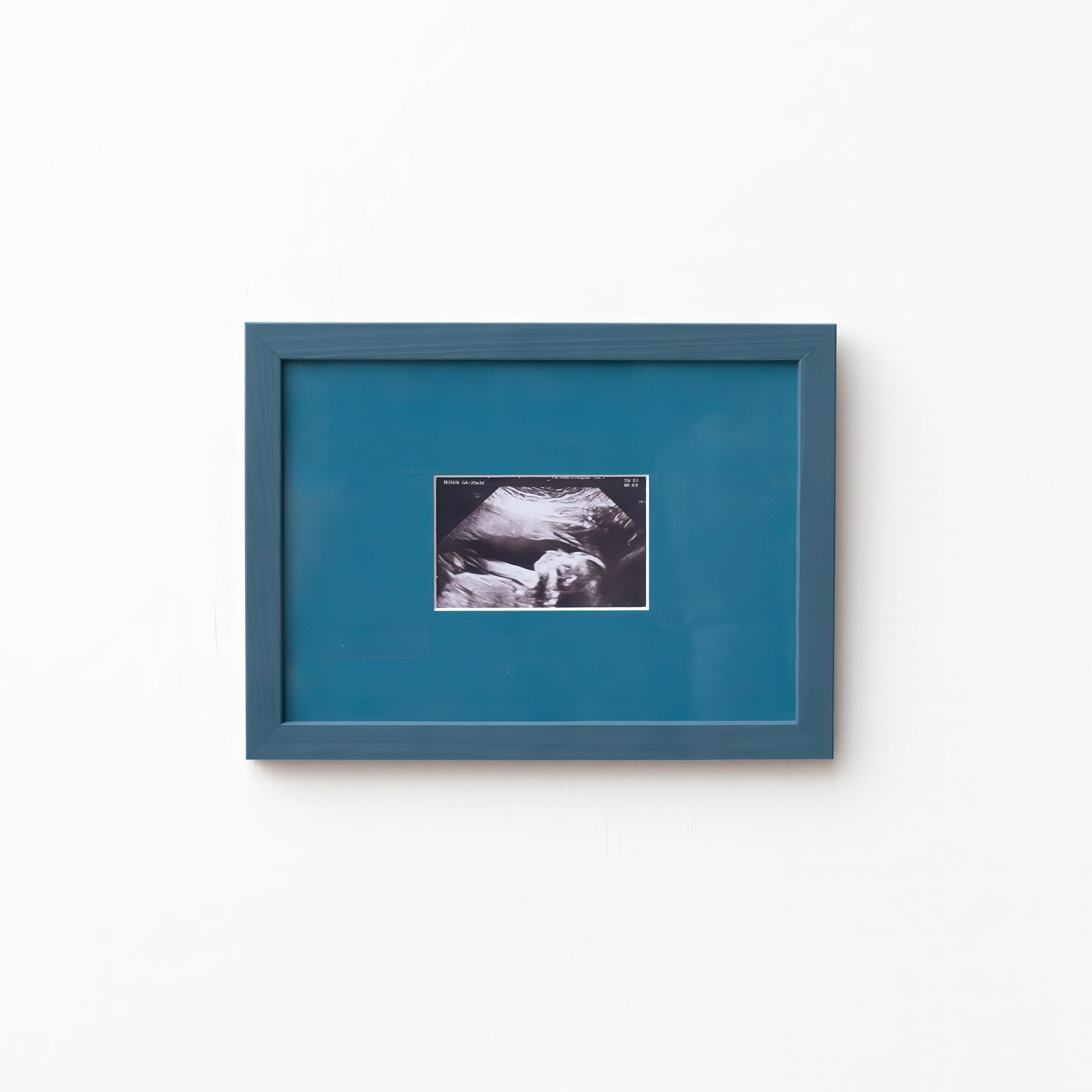An A5 petrol blue frame from Late afternoon with a blue a5 Instax mini mount of an ultrasounds scan