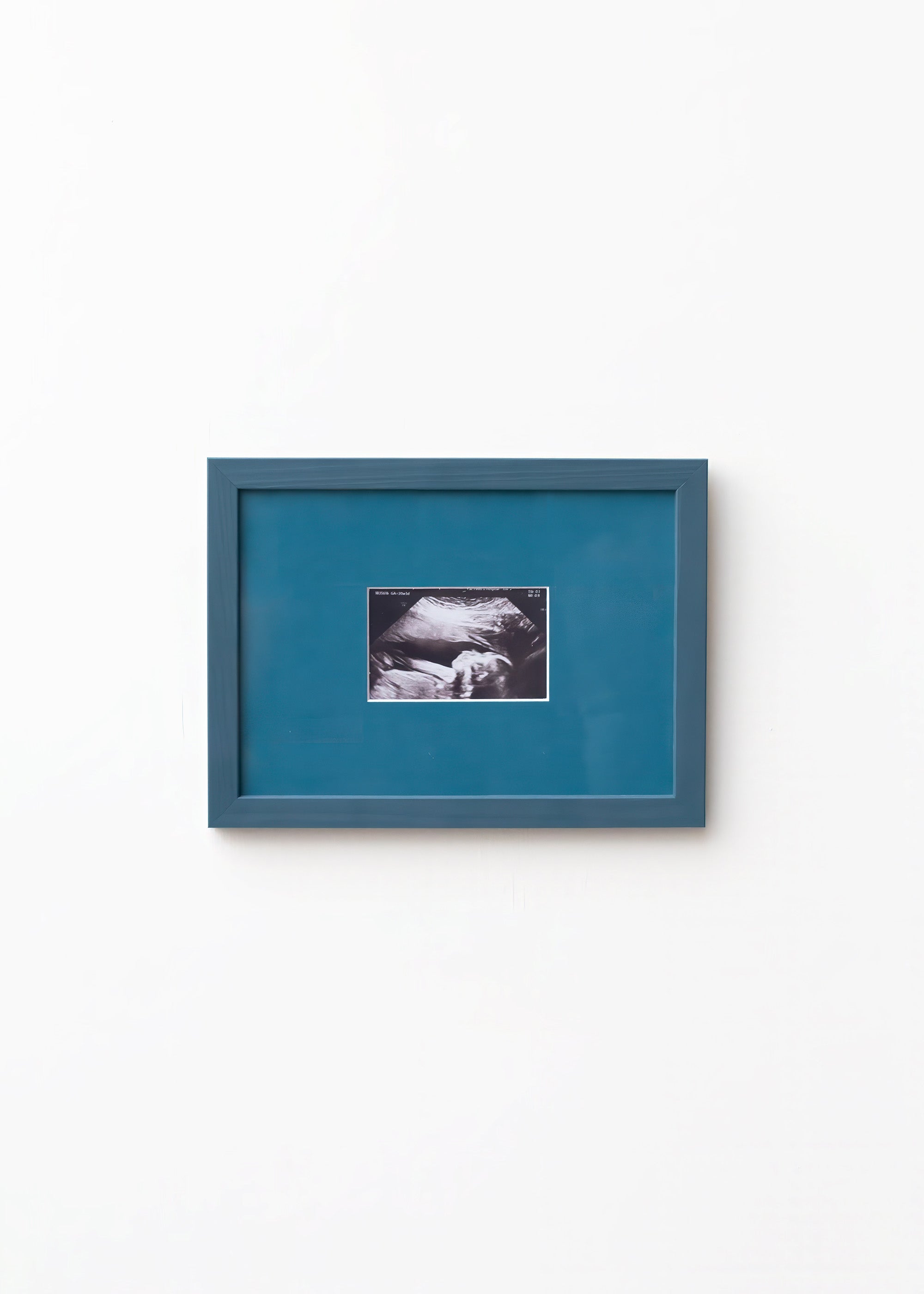 An A5 petrol blue frame from Late afternoon with a blue a5 Instax mini mount of an ultrasounds scan