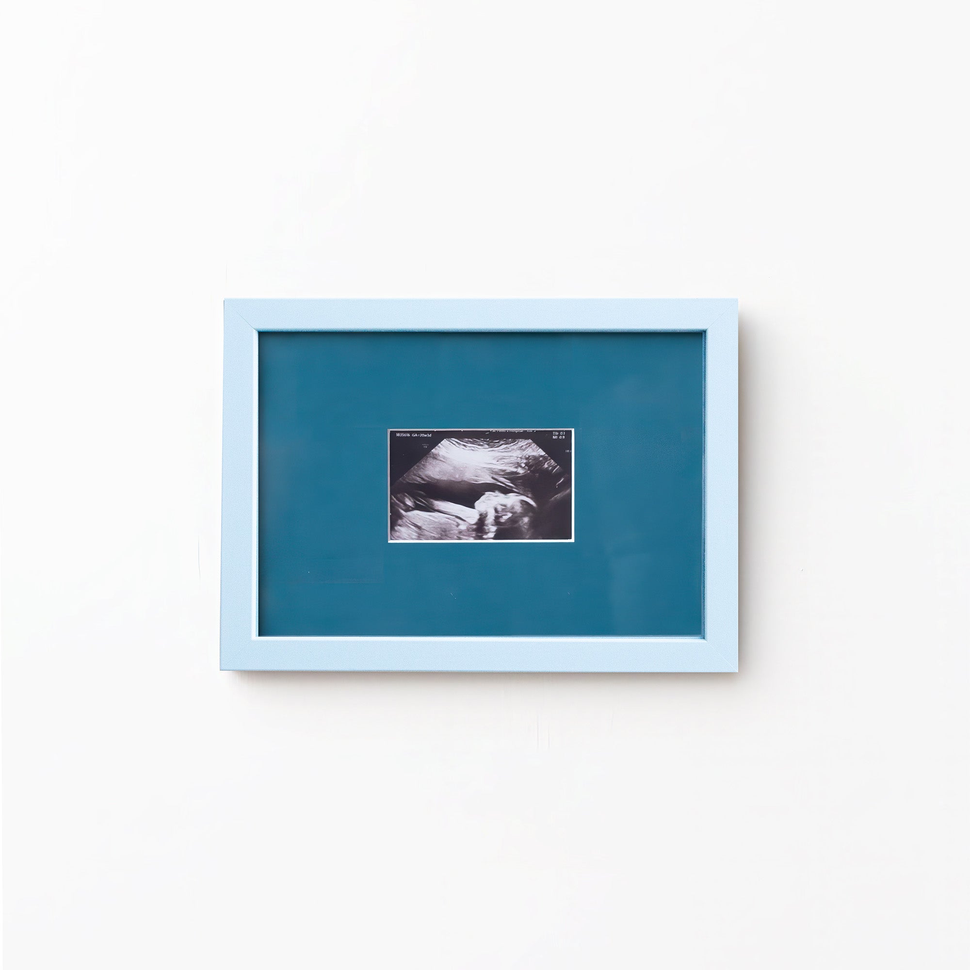 A square framed art print featuring a black and white ultrasound photo of a baby, set against a teal-blue background with a light blue frame, mounted on a plain white wall.
