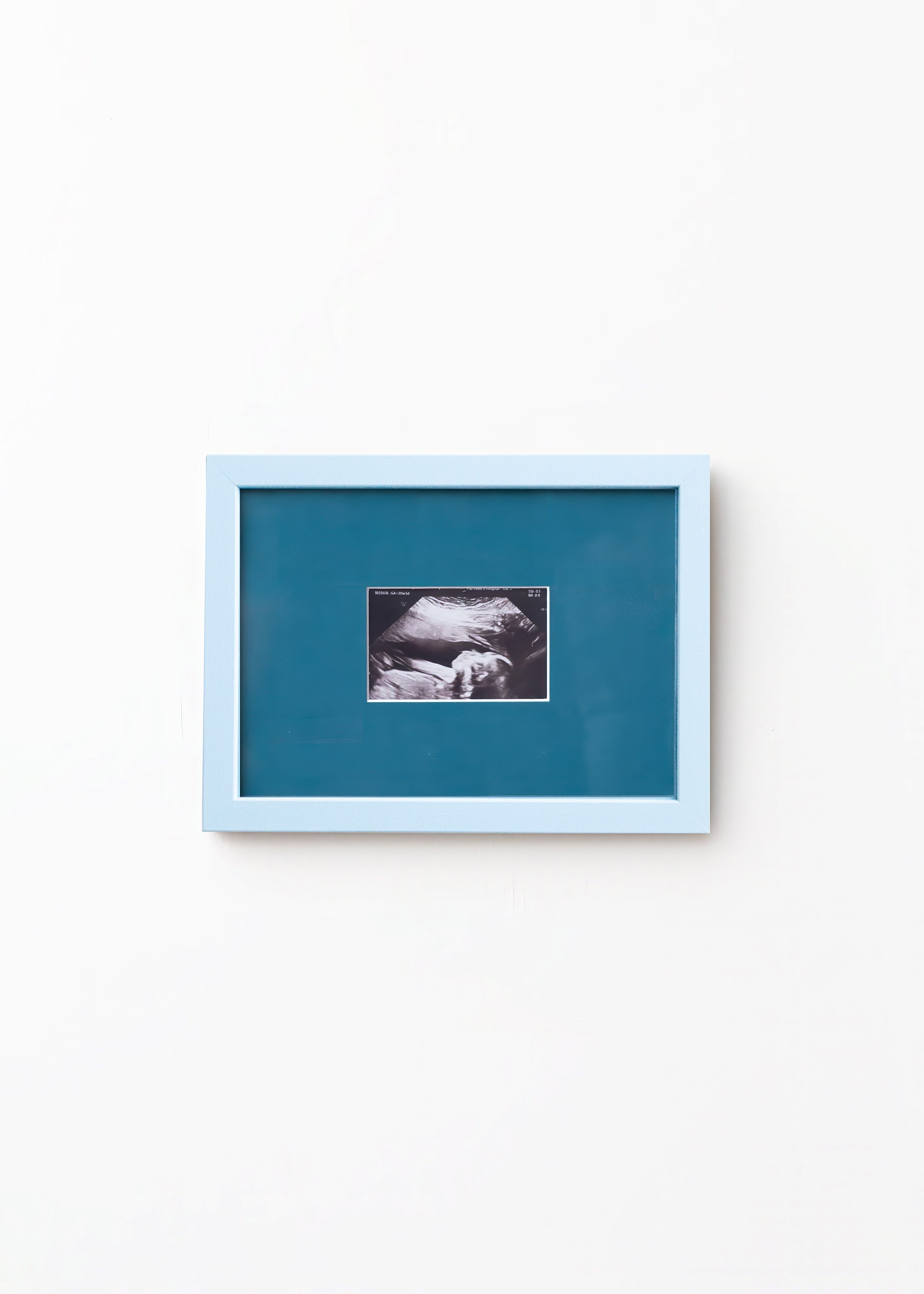 A square framed art print featuring a black and white ultrasound photo of a baby, set against a teal-blue background with a light blue frame, mounted on a plain white wall.